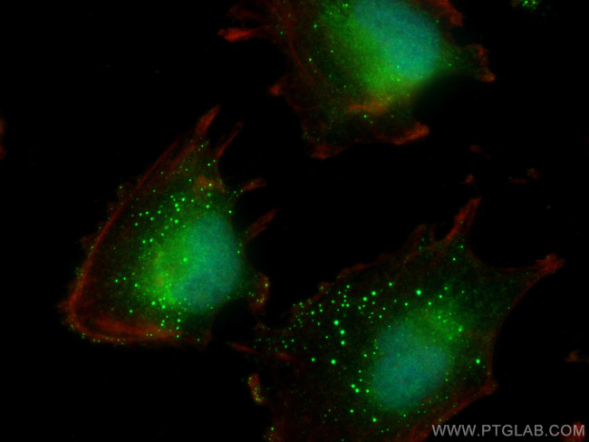 TMEM39A Antibody in Immunocytochemistry (ICC/IF)