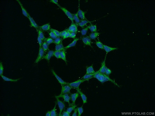 PSEN1 Antibody in Immunocytochemistry (ICC/IF)