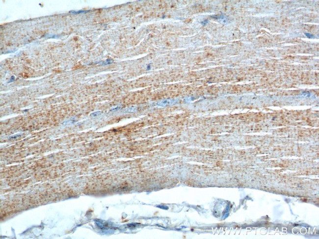 Bestrophin-3 Antibody in Immunohistochemistry (Paraffin) (IHC (P))