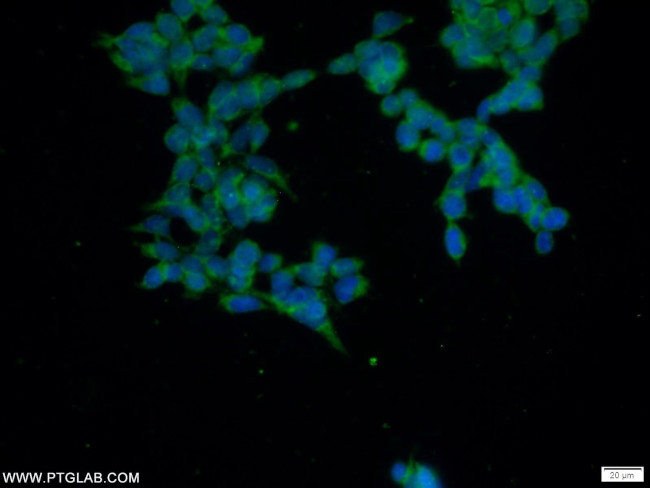 C5orf44 Antibody in Immunocytochemistry (ICC/IF)