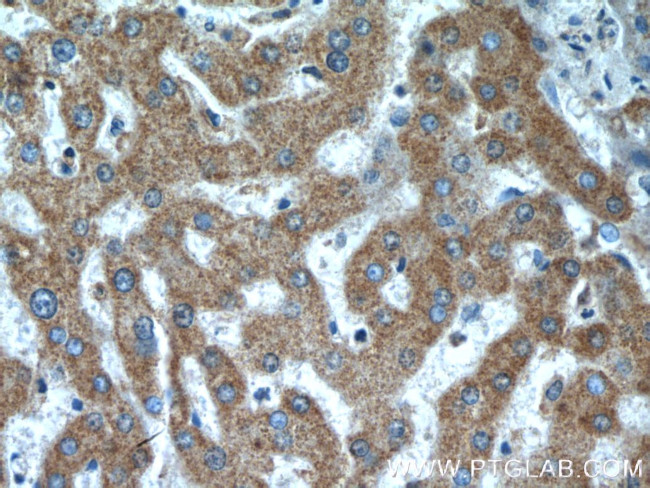 ANKZF1 Antibody in Immunohistochemistry (Paraffin) (IHC (P))
