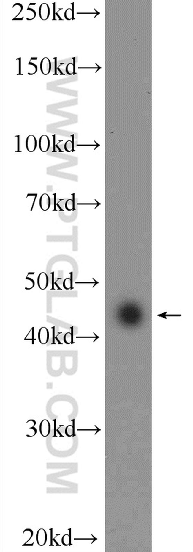 RAPSN Antibody in Western Blot (WB)