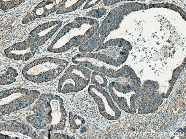 EI24 Antibody in Immunohistochemistry (Paraffin) (IHC (P))