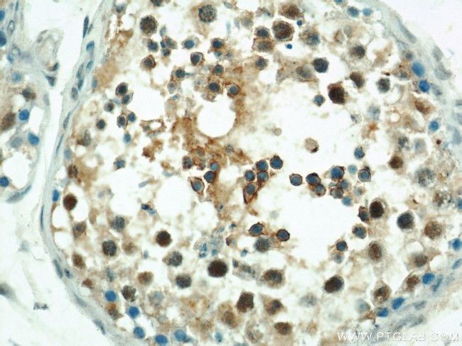 LRRC41 Antibody in Immunohistochemistry (Paraffin) (IHC (P))