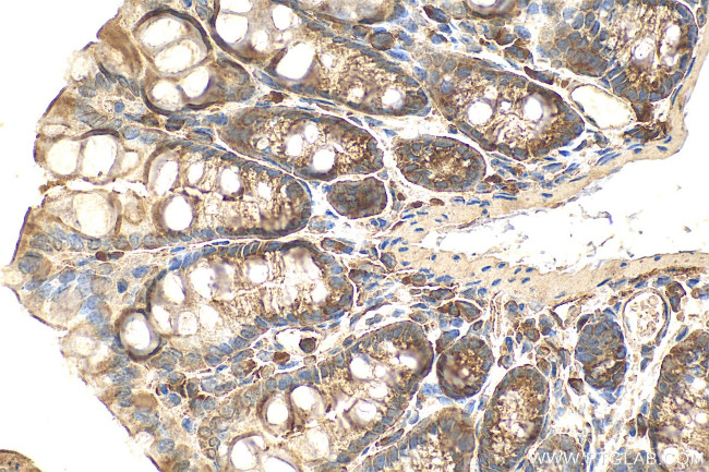 SLC39A3 Antibody in Immunohistochemistry (Paraffin) (IHC (P))