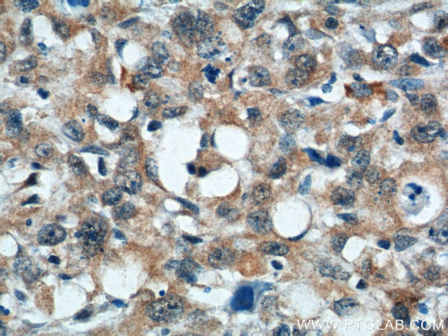 TMEM106A Antibody in Immunohistochemistry (Paraffin) (IHC (P))