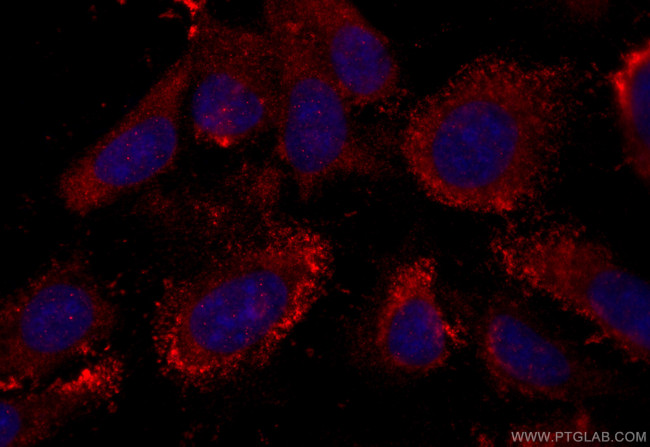 FBXW9 Antibody in Immunocytochemistry (ICC/IF)