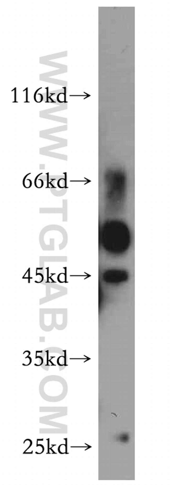 Synaptotagmin-4 Antibody in Western Blot (WB)