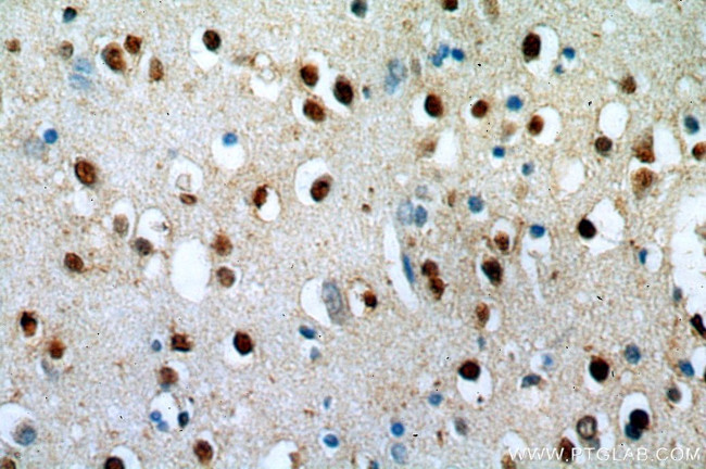 ZNF34 Antibody in Immunohistochemistry (Paraffin) (IHC (P))