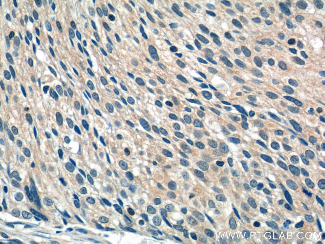 WDR40A Antibody in Immunohistochemistry (Paraffin) (IHC (P))