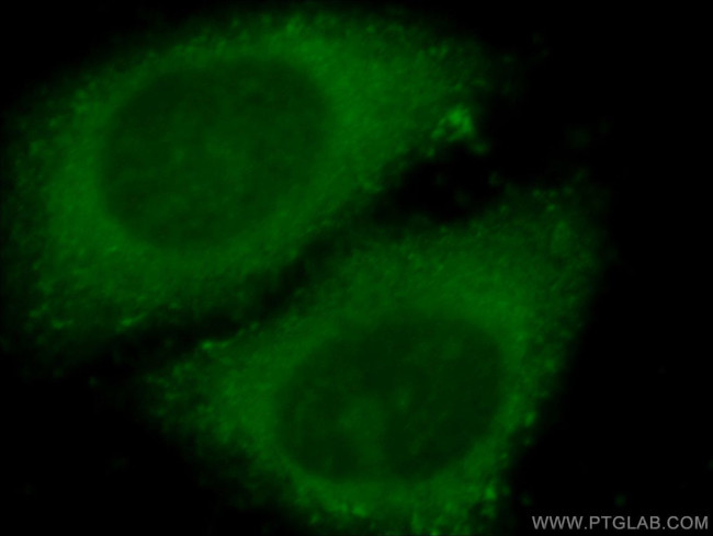 EIF2AK1 Antibody in Immunocytochemistry (ICC/IF)