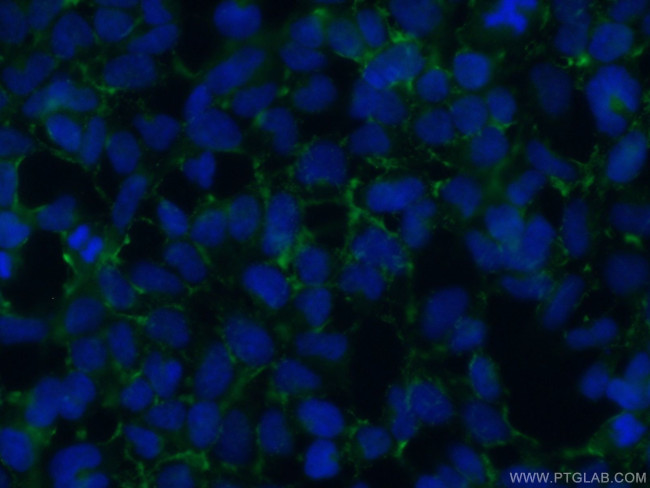 STARD3NL Antibody in Immunocytochemistry (ICC/IF)