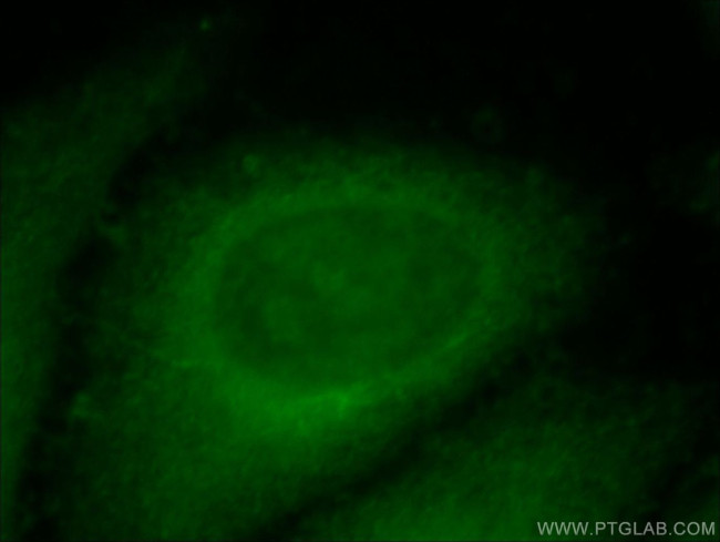 PPPDE1/PNAS4 Antibody in Immunocytochemistry (ICC/IF)