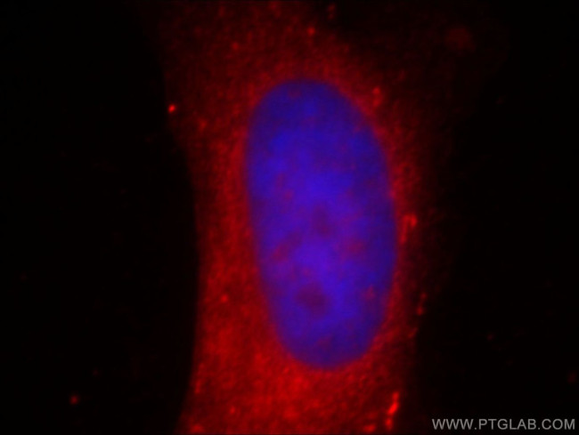 AKR1CL2 Antibody in Immunocytochemistry (ICC/IF)