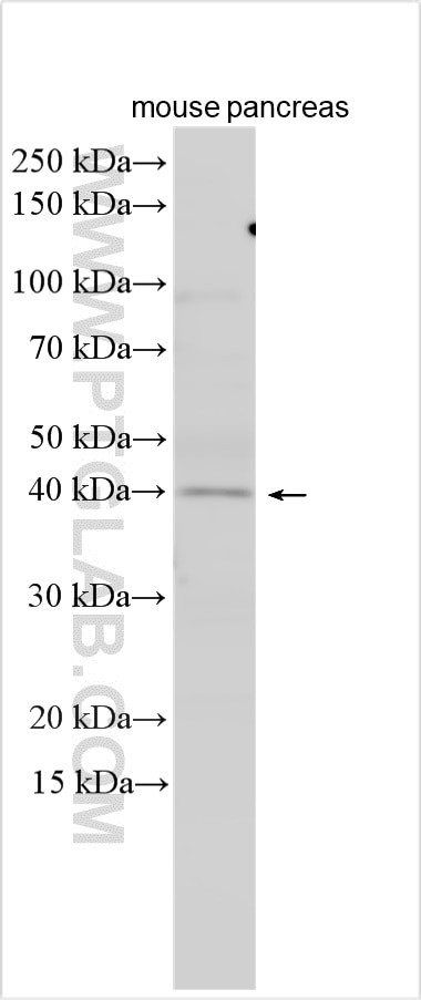 FAM107B Antibody in Western Blot (WB)
