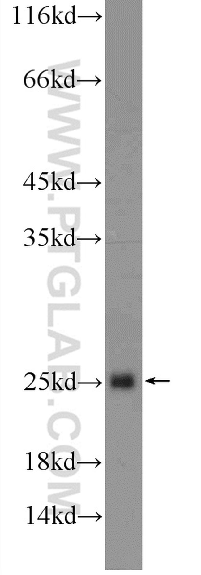 HIST1H3D Antibody in Western Blot (WB)