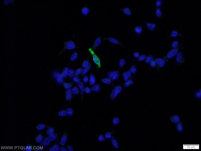DDDDK Tag Antibody in Immunocytochemistry (ICC/IF)
