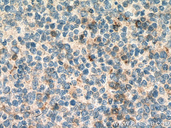 IGFL1 Antibody in Immunohistochemistry (Paraffin) (IHC (P))