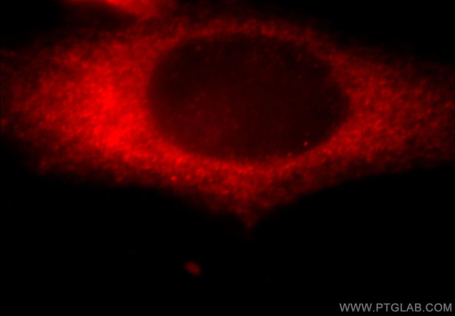 KANK2 Antibody in Immunocytochemistry (ICC/IF)