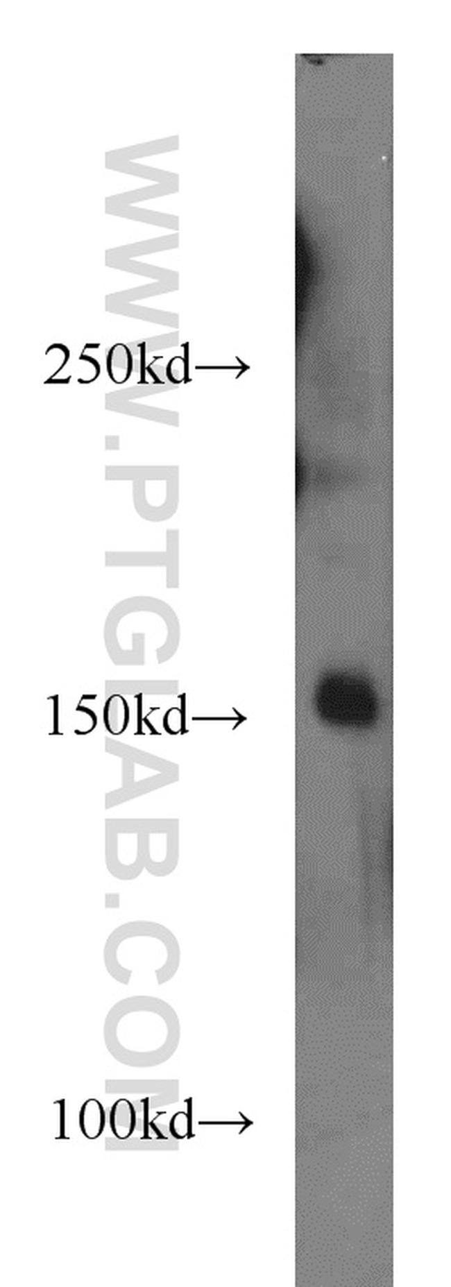 ERCC6/CSB Antibody in Western Blot (WB)