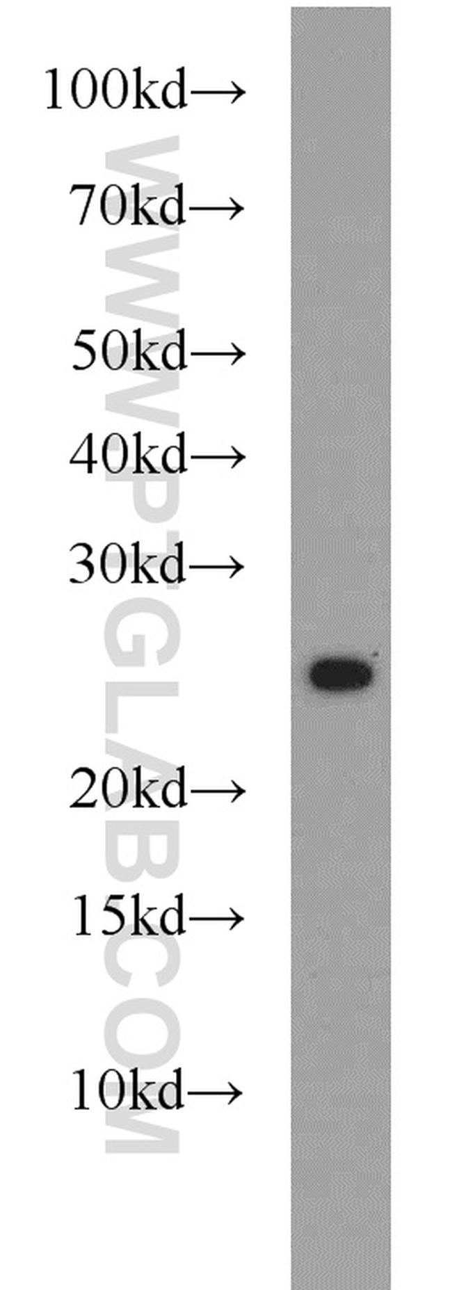 CBLN2 Antibody in Western Blot (WB)