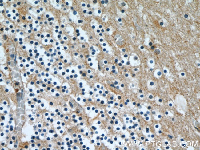 CBLN4 Antibody in Immunohistochemistry (Paraffin) (IHC (P))
