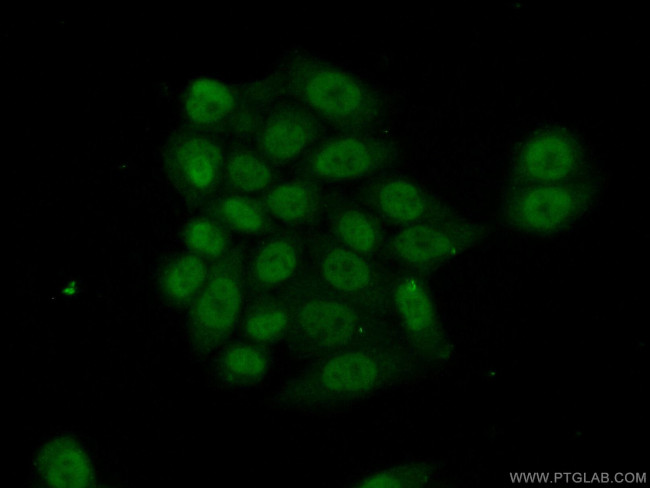 HOXD9 Antibody in Immunocytochemistry (ICC/IF)