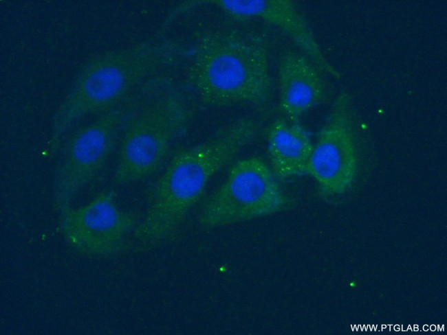 PAFAH1B3 Antibody in Immunocytochemistry (ICC/IF)