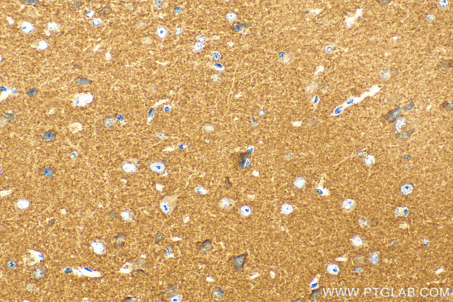 DOC2A Antibody in Immunohistochemistry (Paraffin) (IHC (P))