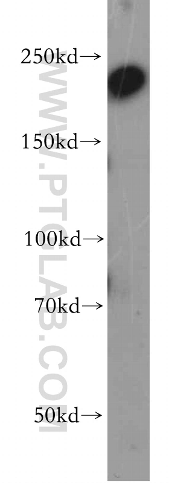 CHD1 Antibody in Western Blot (WB)
