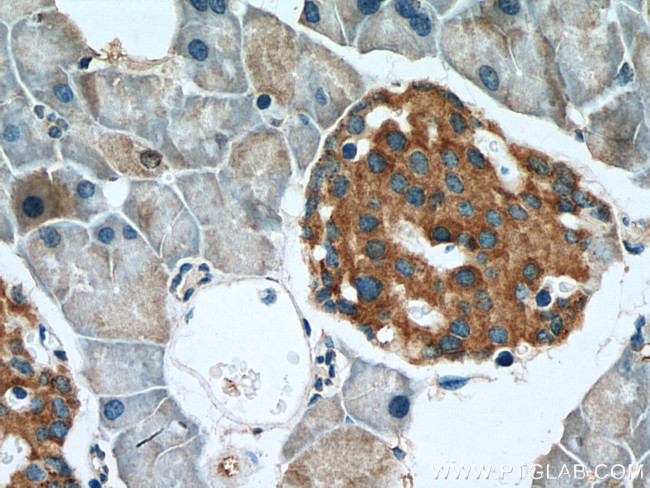 FAM3A Antibody in Immunohistochemistry (Paraffin) (IHC (P))