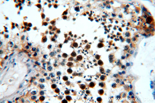 AIM2 Antibody in Immunohistochemistry (Paraffin) (IHC (P))