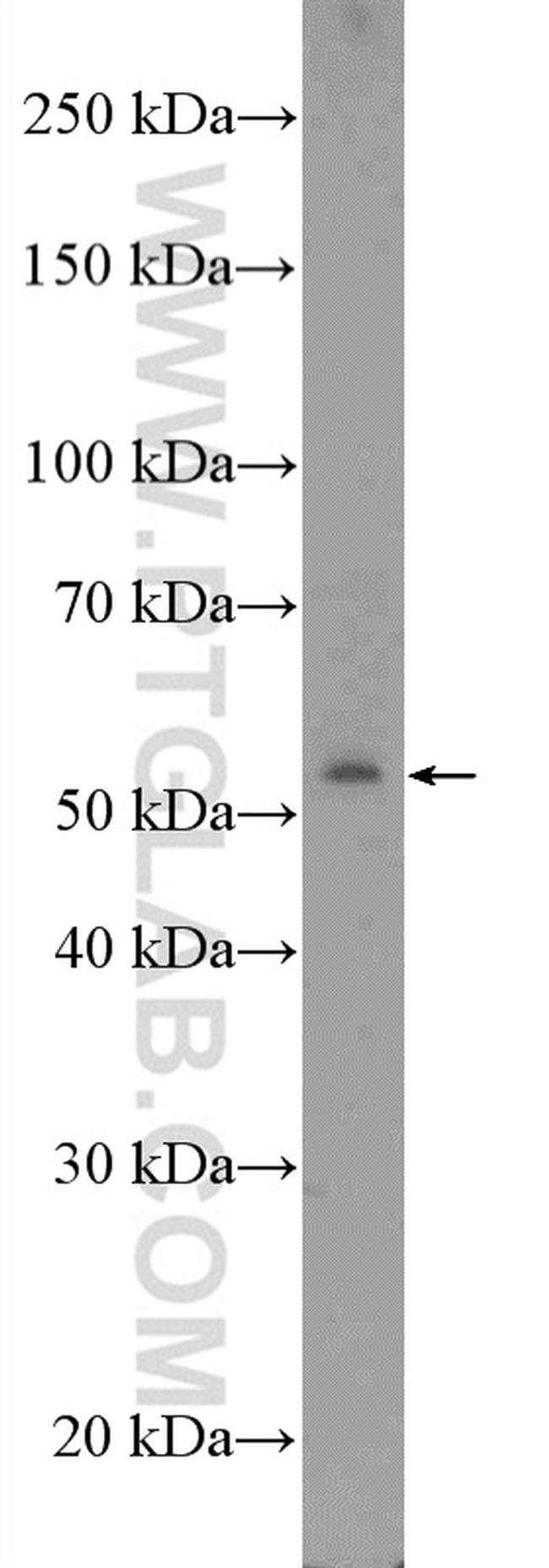 ZNF486 Antibody in Western Blot (WB)