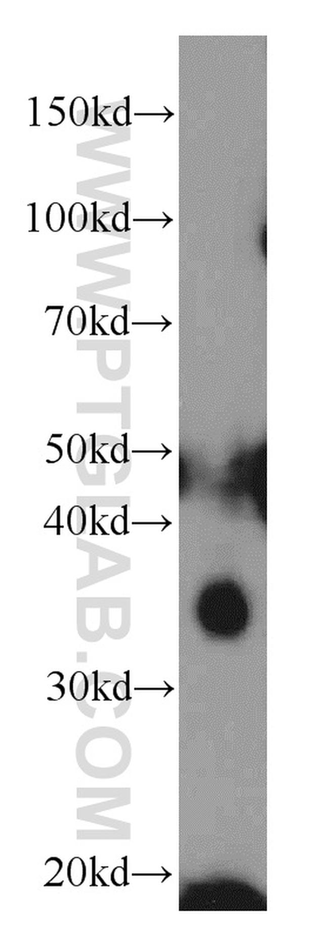 CENPO Antibody in Western Blot (WB)