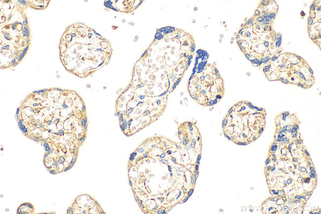 SLC25A40 Antibody in Immunohistochemistry (Paraffin) (IHC (P))