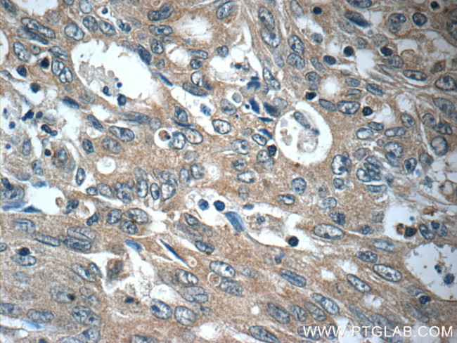 FAM83A Antibody in Immunohistochemistry (Paraffin) (IHC (P))
