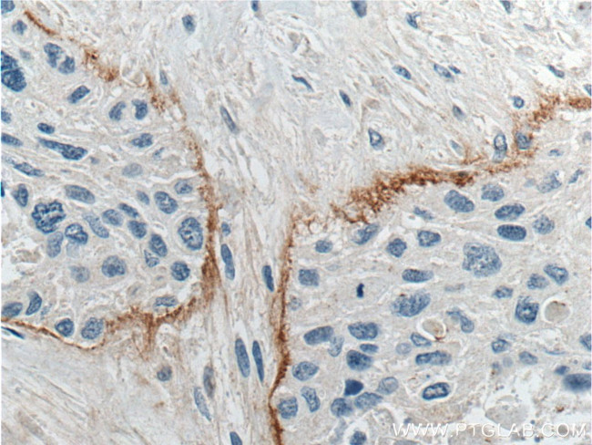 THSD4 Antibody in Immunohistochemistry (Paraffin) (IHC (P))