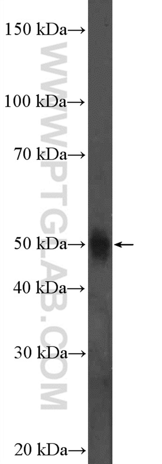 C9orf125 Antibody in Western Blot (WB)