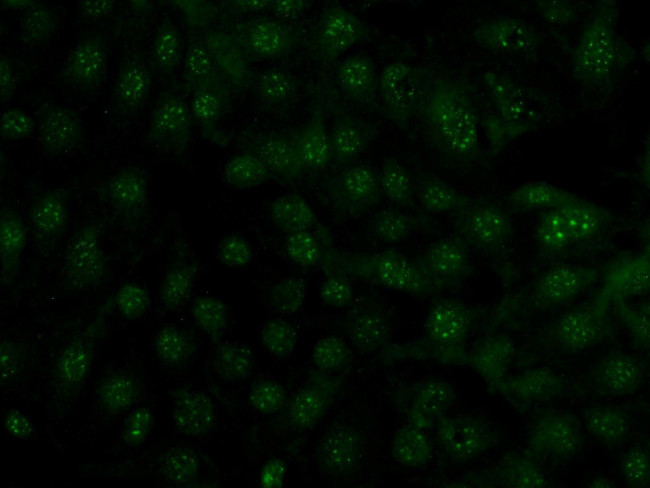 GBA Antibody in Immunocytochemistry (ICC/IF)