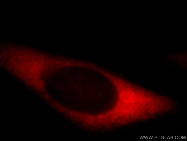 mDia1 Antibody in Immunocytochemistry (ICC/IF)
