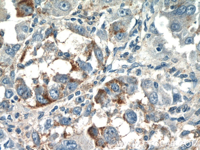 CPPED1 Antibody in Immunohistochemistry (Paraffin) (IHC (P))