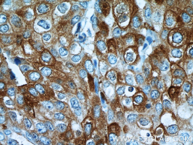 ROR1 Antibody in Immunohistochemistry (Paraffin) (IHC (P))