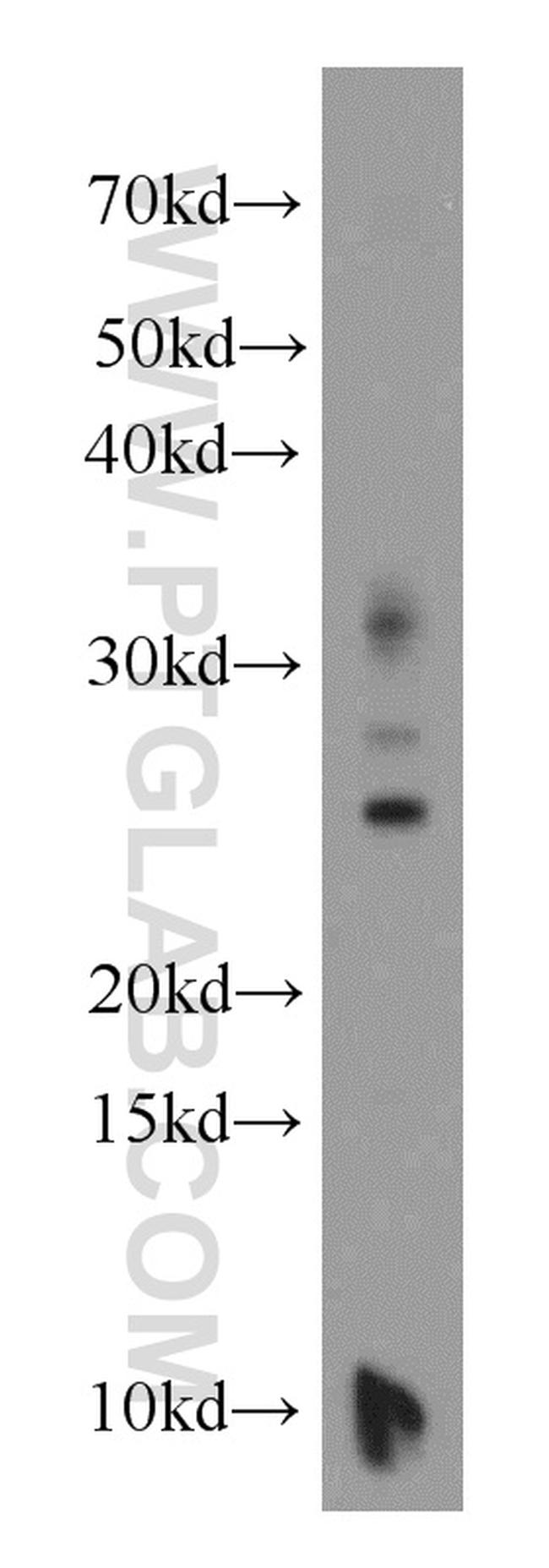 CCDC115 Antibody in Western Blot (WB)