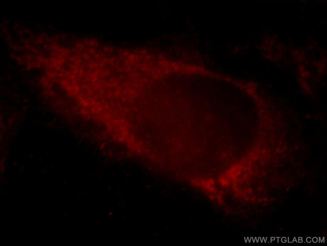 KIAA1191 Antibody in Immunocytochemistry (ICC/IF)