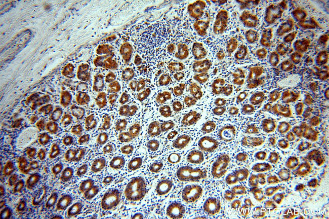 CHCHD6 Antibody in Immunohistochemistry (Paraffin) (IHC (P))
