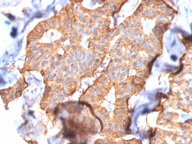 HER-2/c-erbB-2/neu/CD340 Antibody in Immunohistochemistry (Paraffin) (IHC (P))