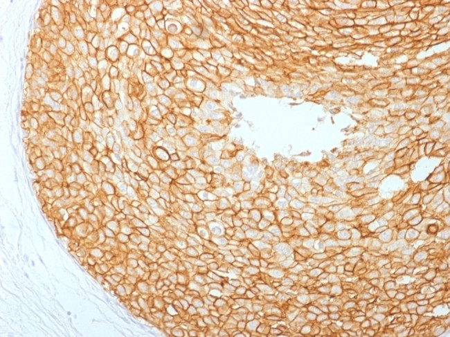 HER-2/c-erbB-2/neu/CD340 Antibody in Immunohistochemistry (Paraffin) (IHC (P))