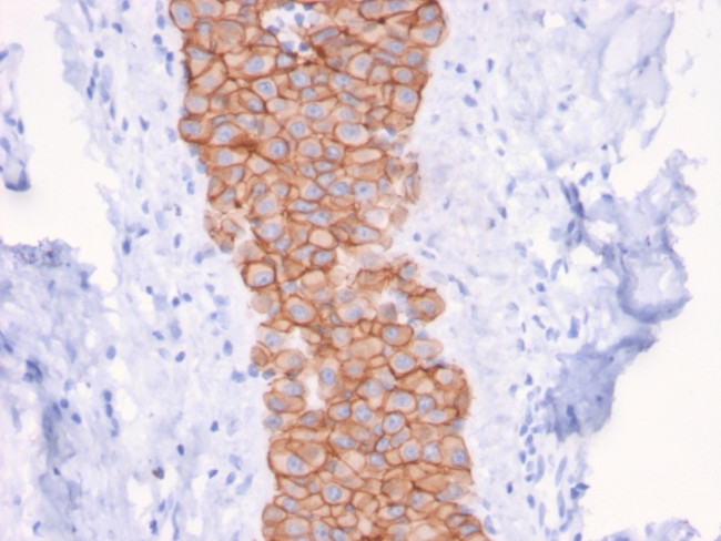 HER-2/c-erbB-2/neu/CD340 Antibody in Immunohistochemistry (Paraffin) (IHC (P))