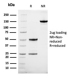 HER-2/c-erbB-2/neu/CD340 Antibody in SDS-PAGE (SDS-PAGE)