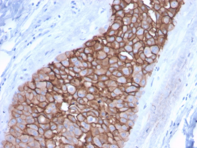 HER-2/c-erbB-2/neu/CD340 Antibody in Immunohistochemistry (Paraffin) (IHC (P))